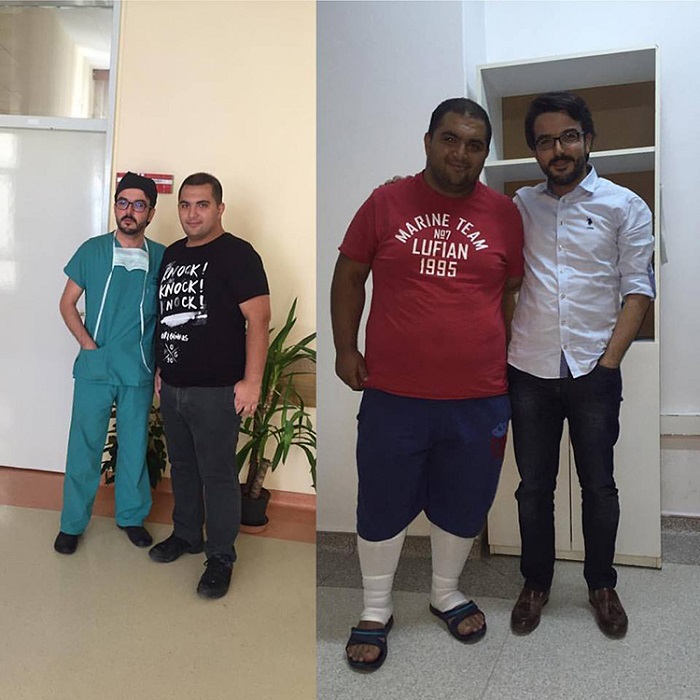 Cumhuriyet Üniversiteis Hastanesi Obezite Cerrahisi Bölgesinde İkinci Sırada